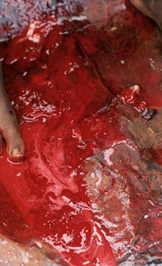 De fleste FGM-relaterte bilder er for grusomme til å vises. Her er ett av de mildeste bildene.